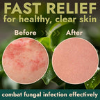 Body Spray with Tea Tree Oil | Fast-Absorbing Antifungal Treatment - Image 5