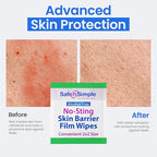 Safe n' Simple No Sting Skin Prep Wipes - Image 7